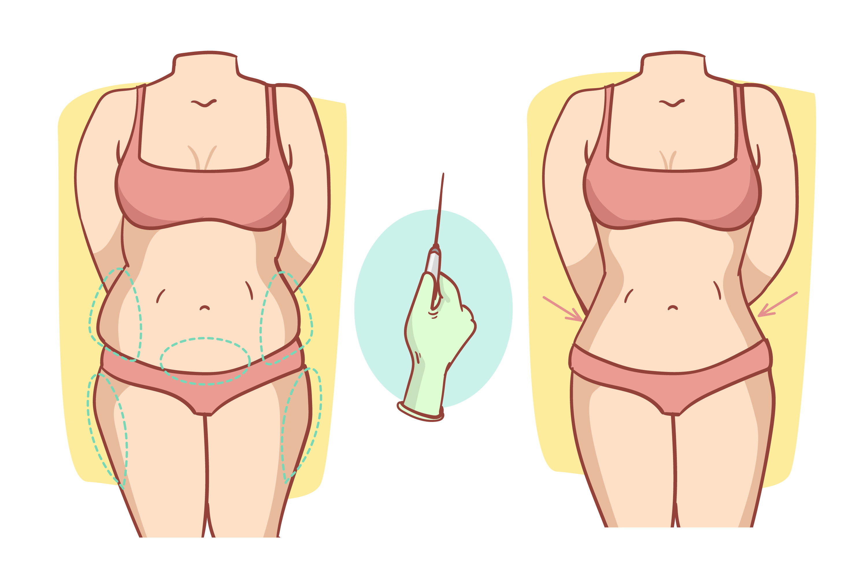 Plastic Surgery